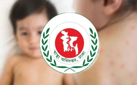 হাম উপসর্গে আরও ৪ শিশুর মৃত্যু, মোট প্রাণহানি ৮৯৪