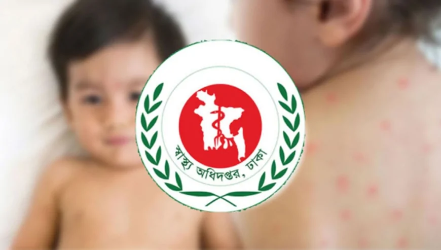 দেশে হাম উপসর্গ নিয়ে আরও ৬ শিশুর মৃত্যু