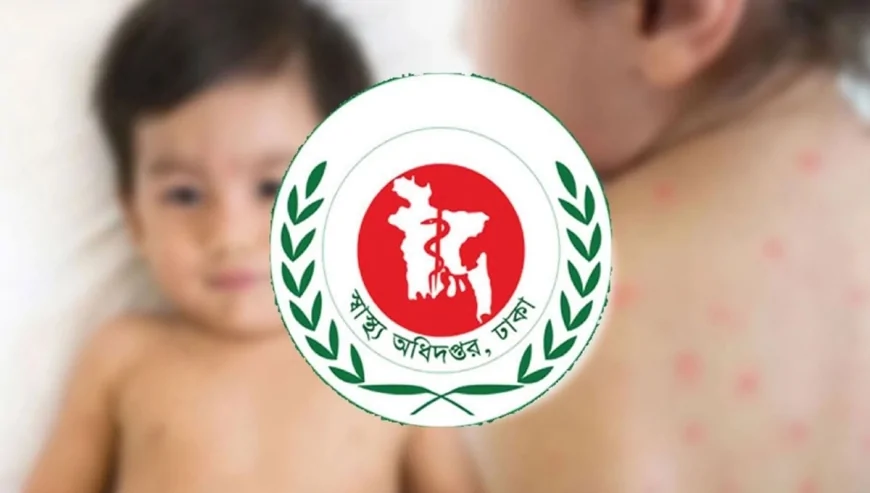 হাম উপসর্গে আরও ৪ শিশুর মৃত্যু, মোট প্রাণহানি ৮৯৪