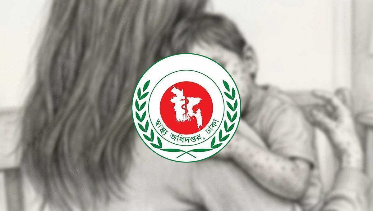 হাম উপসর্গে ২৪ ঘণ্টায় আরও ৯ শিশুর মৃত্যু